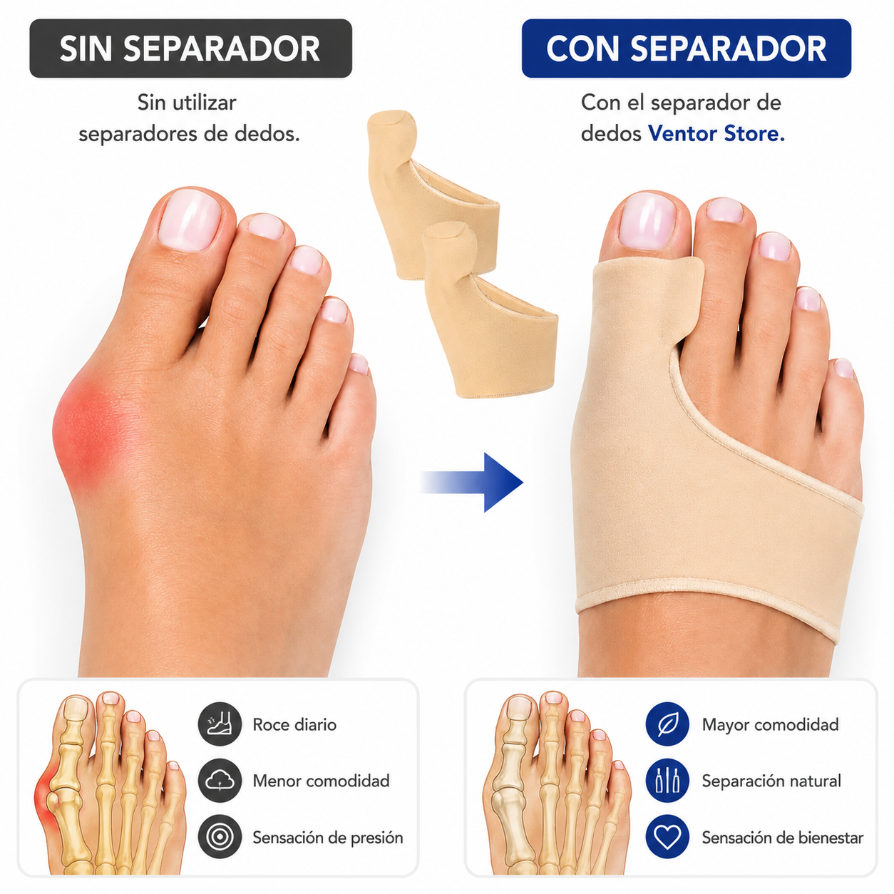 ConfortPie Pro™ – Separador de Dedos para Alivio Diario